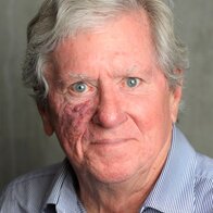 Terry Tyrrell
